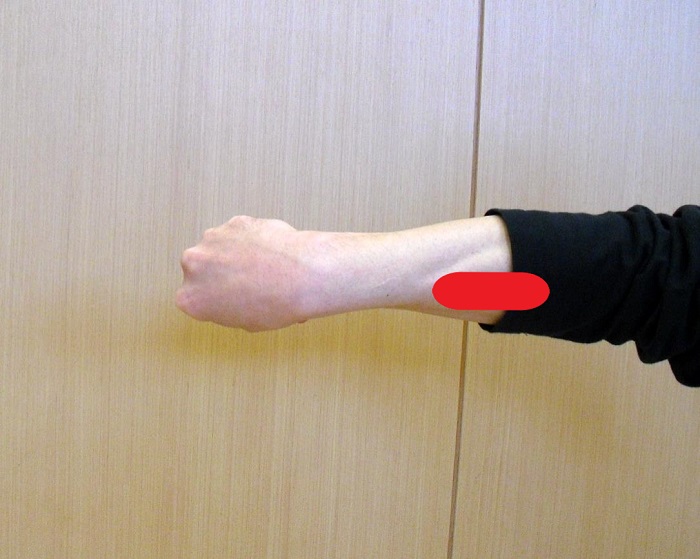 腕打で使用する前腕部の写真